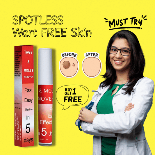 Dermoso Skin Tag & Moles Remover Buy 1 Get 1 Free (Pack of 2)